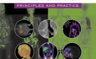 Molecular Imaging: Principles and Practice