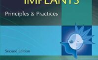 Cochlear Implants: Principles & Practice